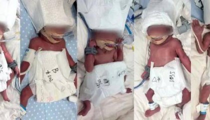 新疆一24岁产妇凌晨生下5胞胎（1男4女），最重1030克，最轻仅870克，概率六千万分之一