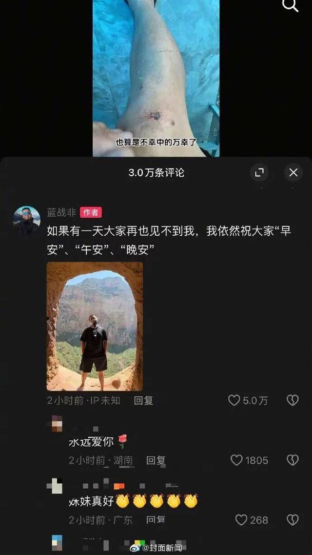 千万粉丝网红“蓝战非”解封后更新,称在非洲旅行遭遇车祸